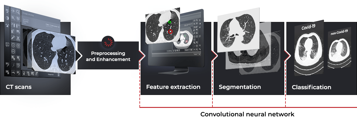 AI-powered CT image analysis